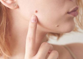 Virus HPV là nguyên nhân trực tiếp gây nên tình trạng mụn cóc trên mặt