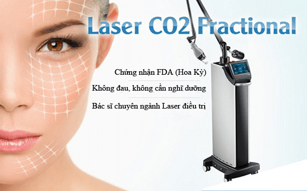 Điều trị dứt điểm mụn thịt ở lưng bằng Laser C02 Fractional