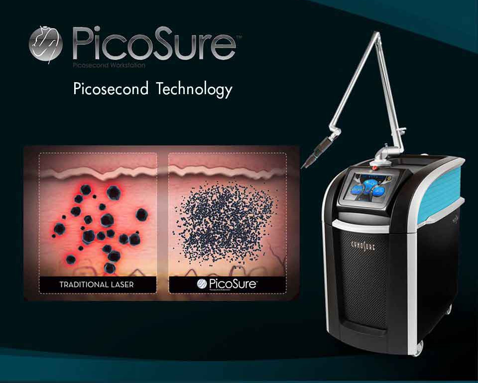 Phương pháp xóa xăm môi hiệu quả - Laser Picosure