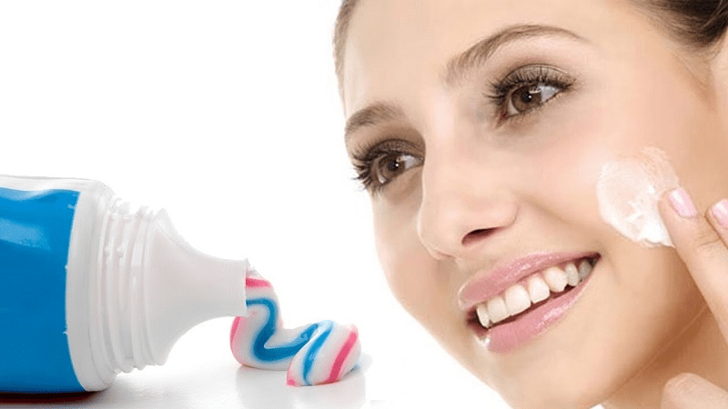 Trị mụn bằng kem đánh răng được nhiều người lựa chọn